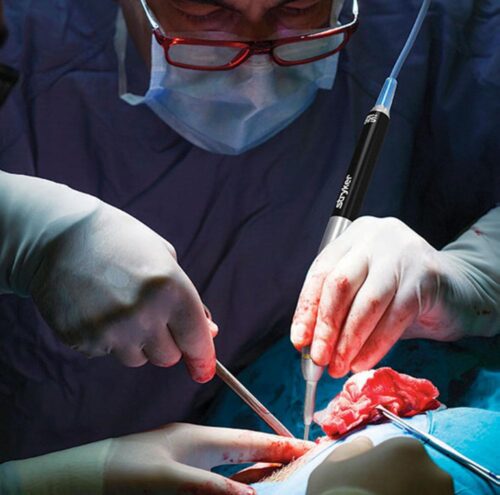 surgical team performing surgery
