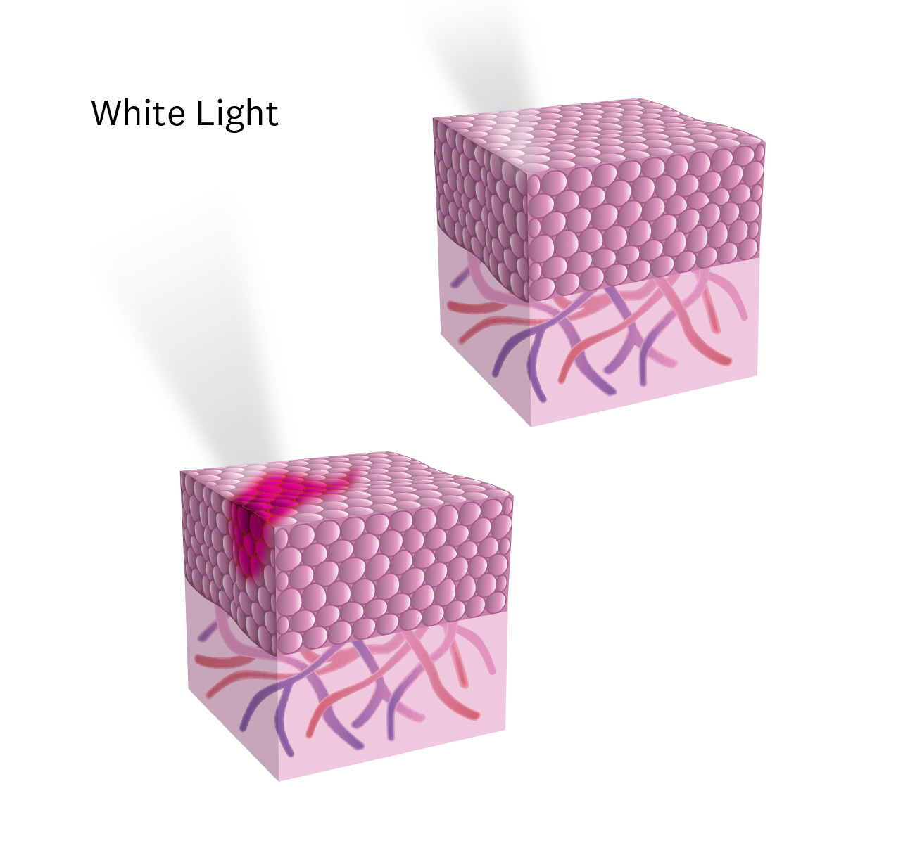 white light image